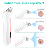 HD Visual Electric Blackhead Remover