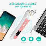 HD Visual Electric Blackhead Remover