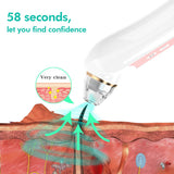 HD Visual Electric Blackhead Remover